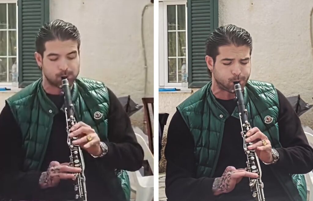 Άρης Μουγκοπέτρος: «Εδώ είμαι πάλι» – Παίζει πάλι κλαρίνο ένα χρόνο μετά τον σοβαρό τραυματισμό του από κροτίδα